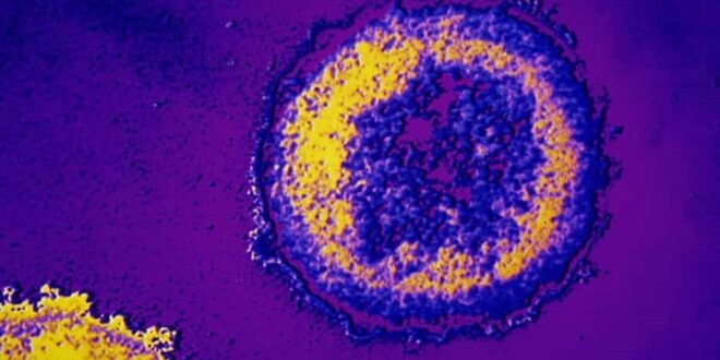 شفاء أول امرأة من مرض الـ”إيدز” باستخدام الخلايا الجذعية