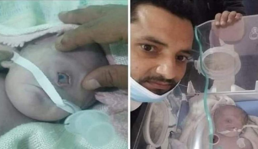 مولود بعين واحدة في البيضاء اليمنية نتيجة استخدام الرياض أسلحة محرمة!