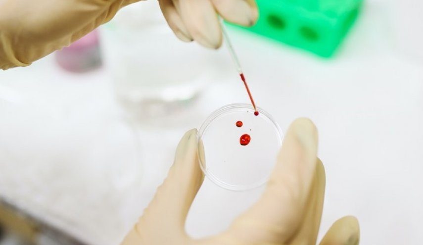 أصحاب هذه الفصيلة من الدم أكثر عرضة لـ"الخرف" بنسبة 82%