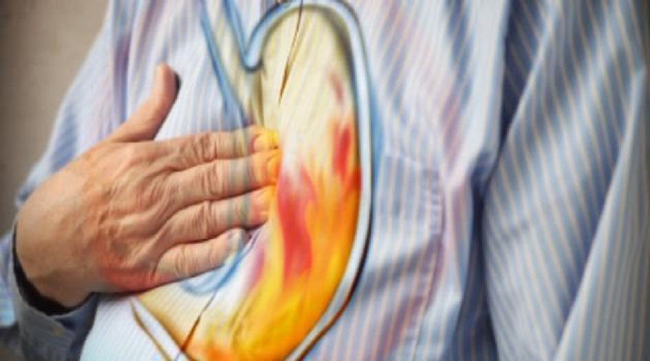 أسرع طريقة للتخلص من حموضة المعدة.. عليك اتباعها