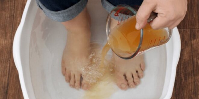  يمكن أن يفعل العجائب...حمام من الخل لقدميك