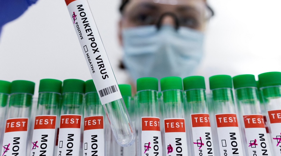  أعراض جدري القرود تختلف عن تفشيات سابقة ؟!