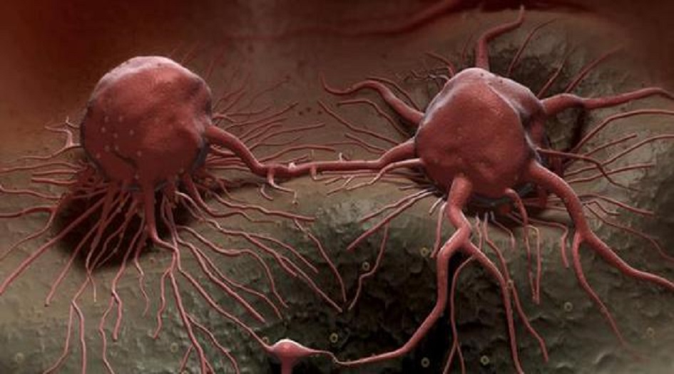 لماذا لا يمكن القضاء على جميع أنواع السرطان؟!