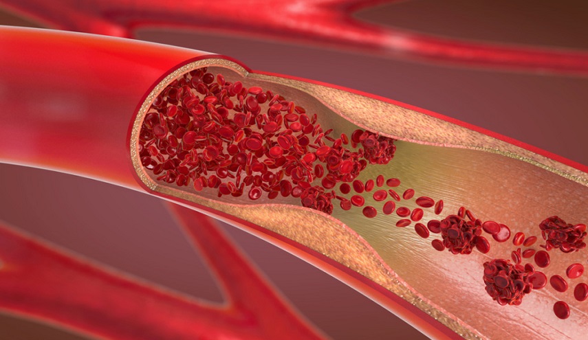 ما هي  الأعراض التي تشير إلى أن أوعيتك الدموية ضعيفة ؟