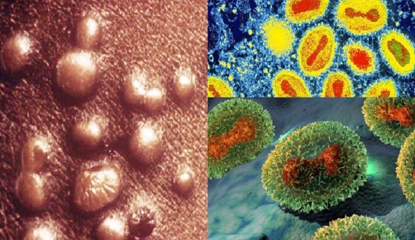  فيروس جدري القردة يتلاشى عند تسخينه لهذه الدرجة.. دراسة تكشف