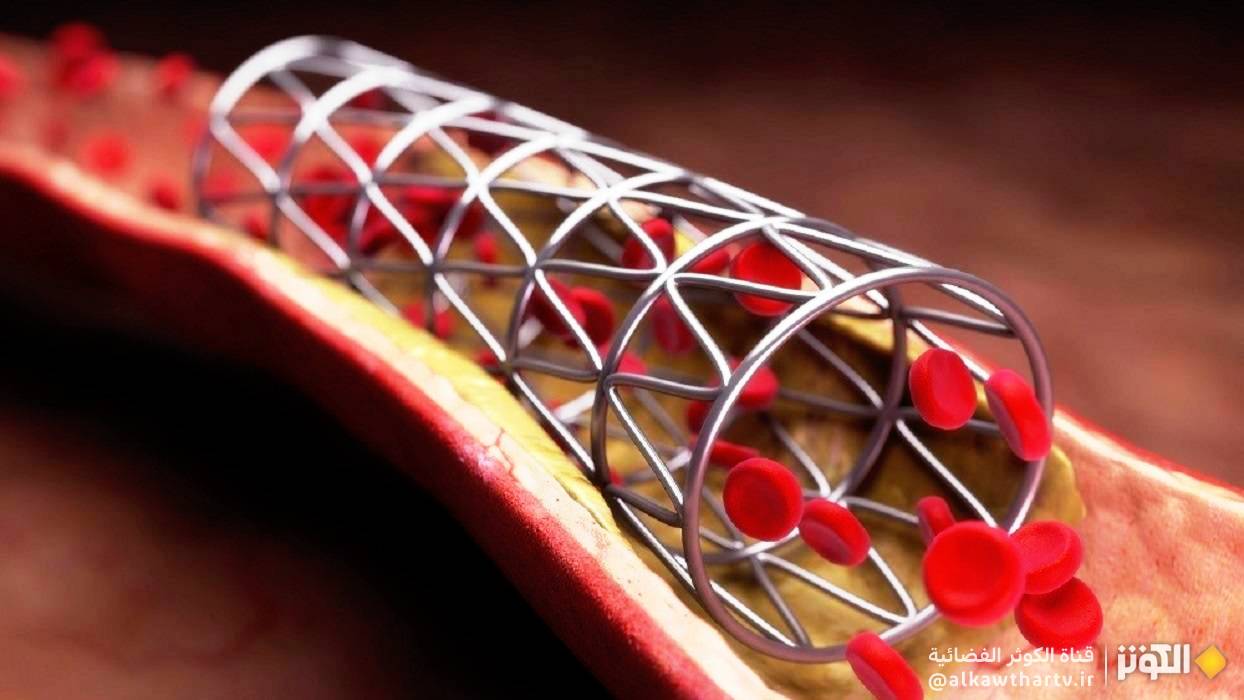  منتج حيوي إيراني لعلاج أمراض القلب 