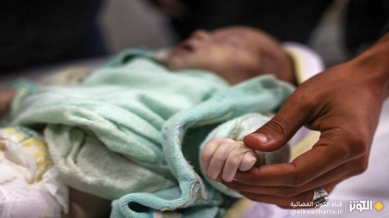 الأونروا: تصاعد في حالات سوء التغذية بغزة وسط نقص حاد في الإمدادات الطبية