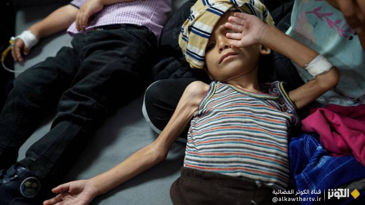 كارثة إنسانية في غزة ... آلاف الأطفال يواجهون الجوع وسوء التغذية