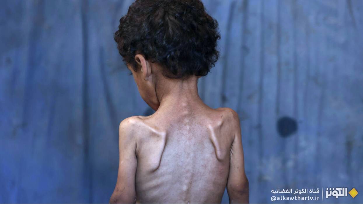 مدير عام مجمع الشفاء الطبي في غزة يحذر من تفاقم الأوضاع الكارثية في القطاع