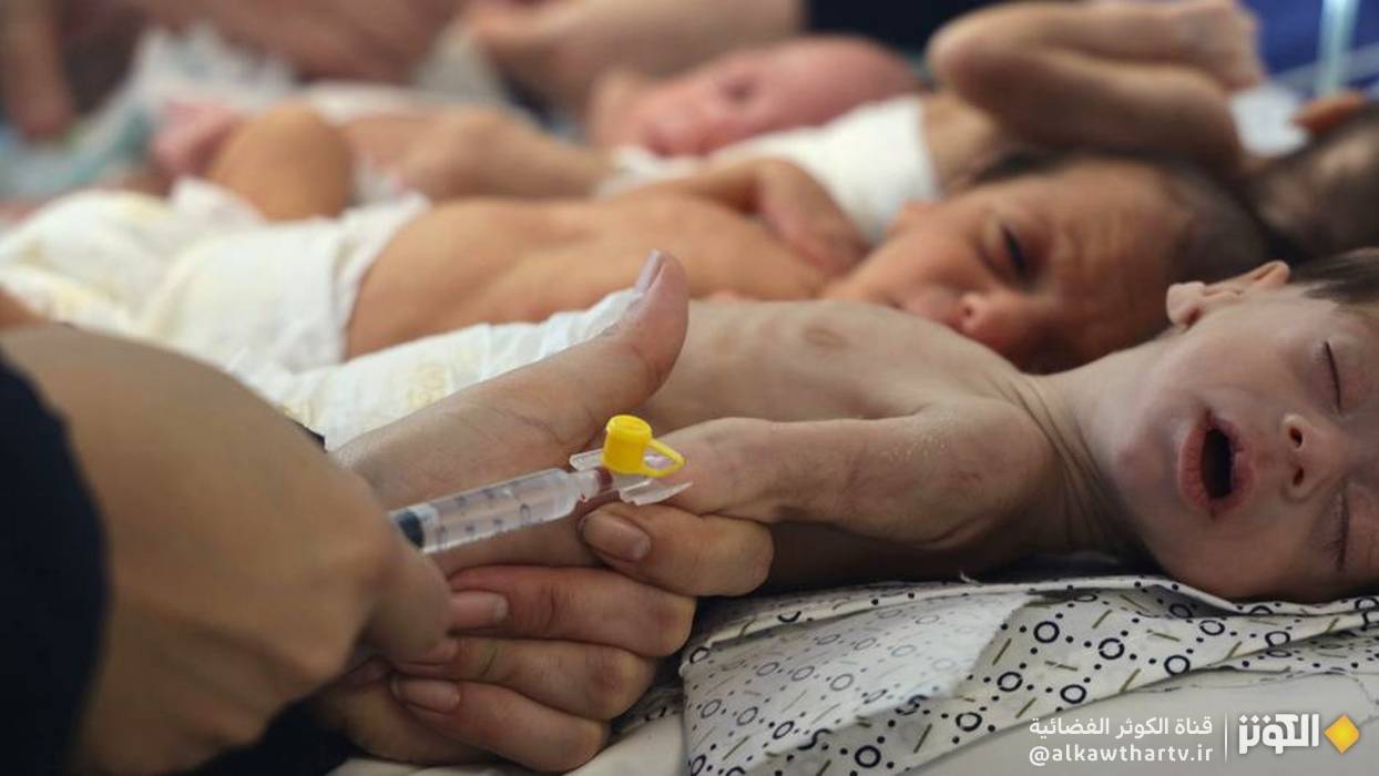 معظم أطفال غزة معرضون للموت إذا لم يتلقوا العلاج فورا