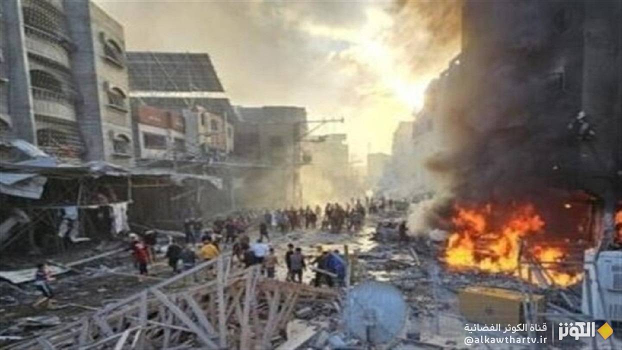 75 شهيدًا و304 إصابات جراء عدوان الاحتلال على غزة خلال 24 ساعة