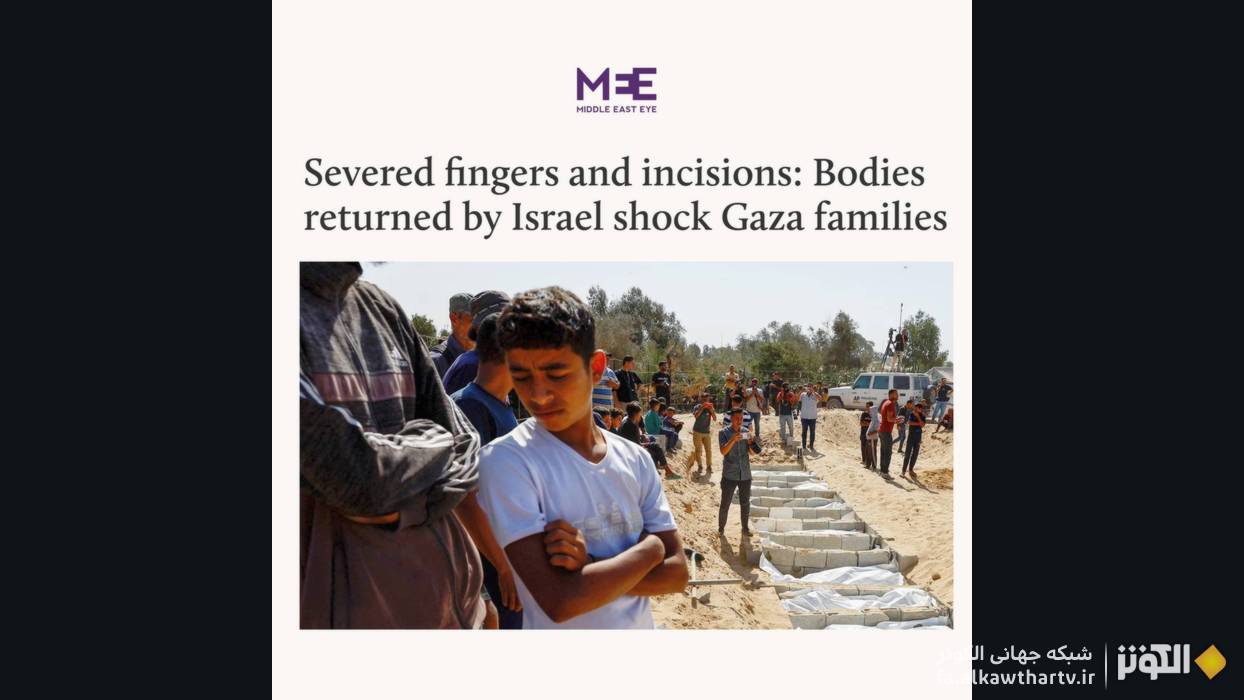 شوک خانواده‌ها از تحویل اجساد مثله‌شده توسط رژیم صهیونی، آثار شکنجه و قطع عضو 